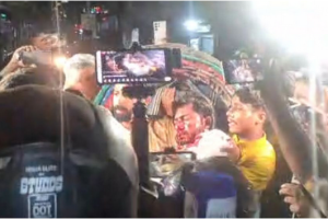 জাপা কার্যালয়ের সামনে পুলিশের লাঠিচার্জে গুরুতর আহত নুরুল হক নুর