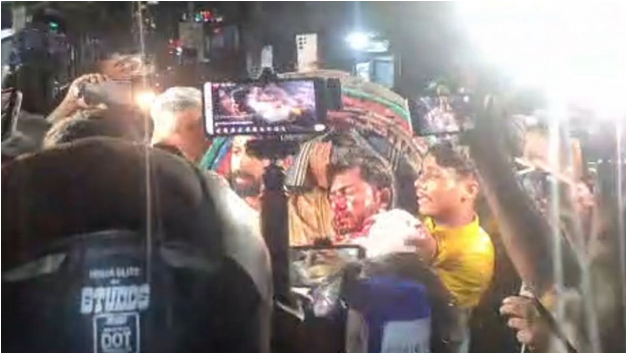 জাপা কার্যালয়ের সামনে পুলিশের লাঠিচার্জে গুরুতর আহত নুরুল হক নুর